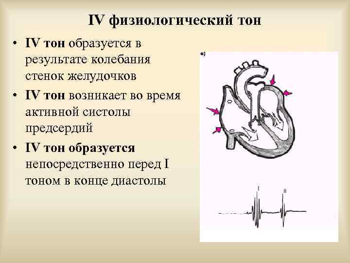 IV физиологический тон • IV тон образуется в результате колебания стенок желудочков • IV