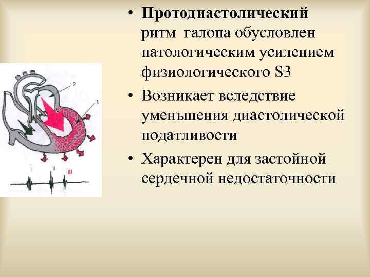  • Протодиастолический ритм галопа обусловлен патологическим усилением физиологического S 3 • Возникает вследствие