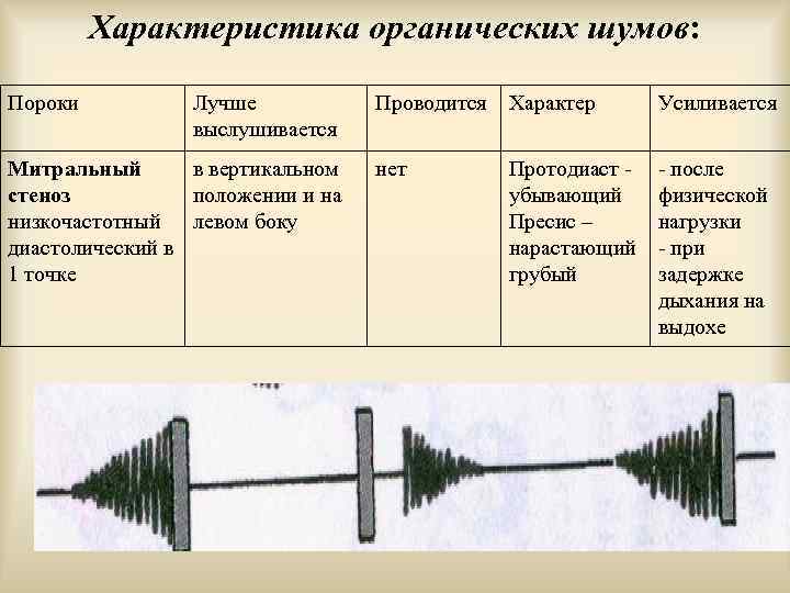 Шум остина флинта выслушивается в точке обозначенной на рисунке цифрой