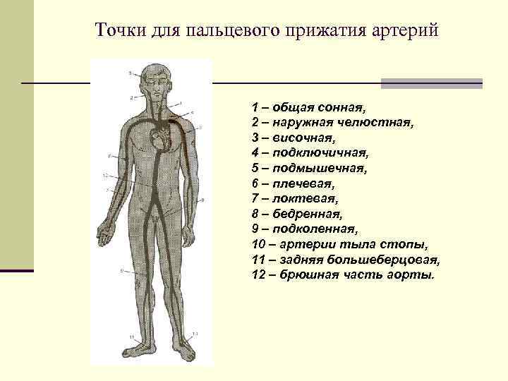 Точки для пальцевого прижатия артерий 1 – общая сонная, 2 – наружная челюстная, 3