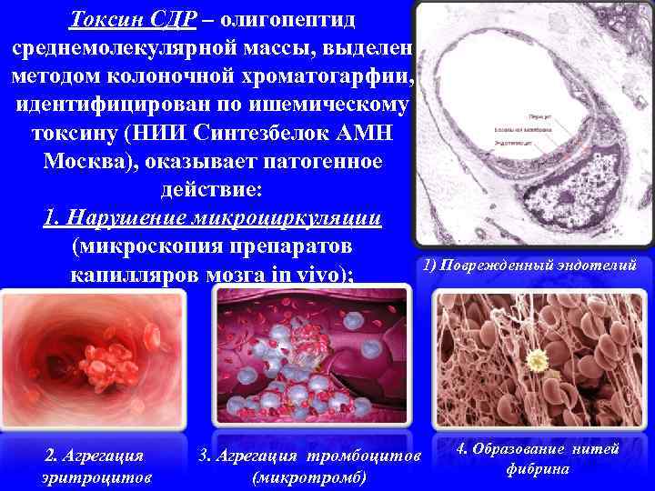 Токсин СДР – олигопептид среднемолекулярной массы, выделен методом колоночной хроматогарфии, идентифицирован по ишемическому токсину