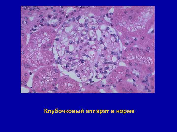 Клубочковый аппарат в норме 