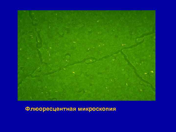 Флюоресцентная микроскопия 