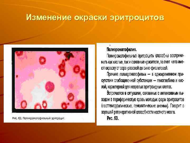Изменение окраски эритроцитов 