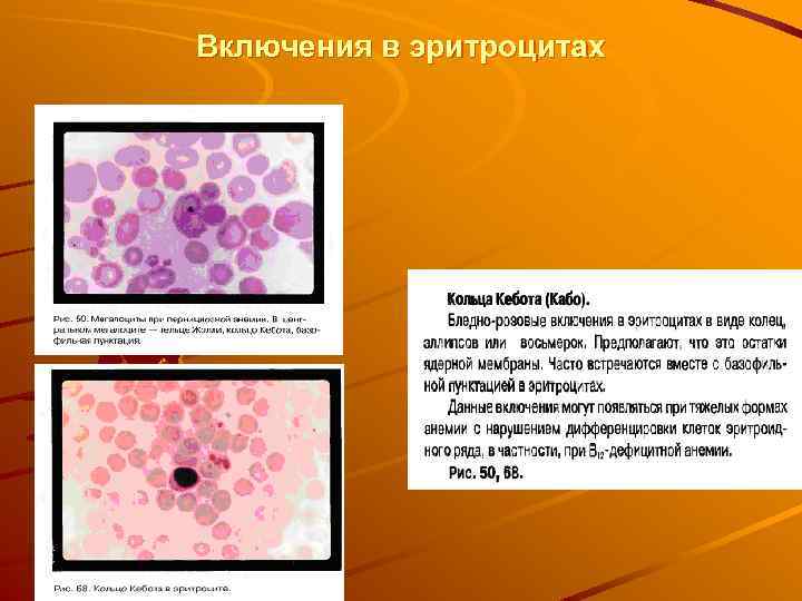 Включения в эритроцитах 