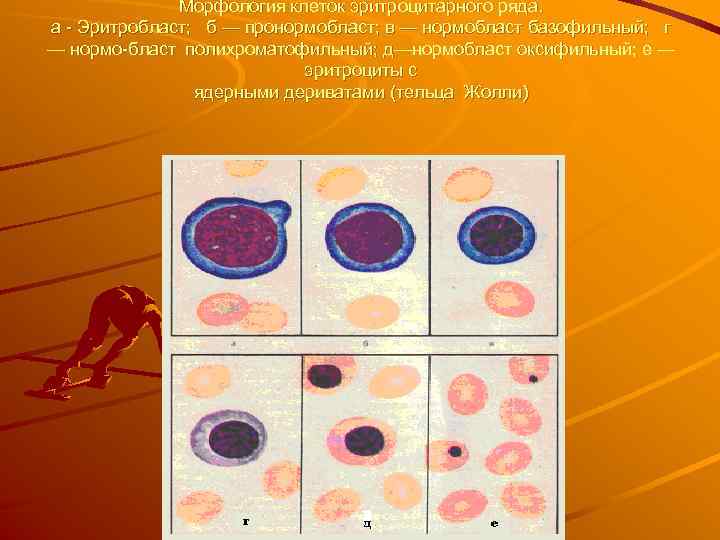 Морфология клеток эритроцитарного ряда. а Эритробласт; б — пронормобласт; в — нормобласт базофильный; г