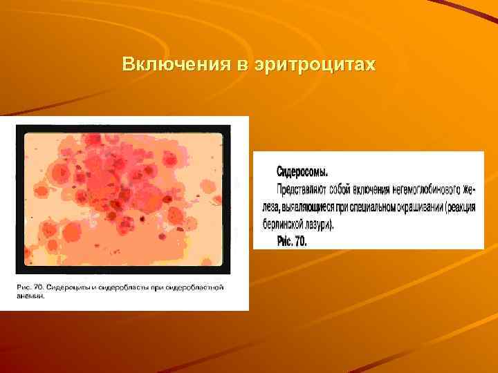 Включения в эритроцитах 