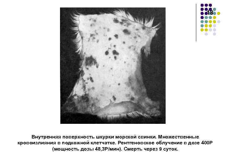 18 Внутренняя поверхность шкурки морской свинки. Множественные кровоизлияния в подкожной клетчатке. Рентгеновское облучение в