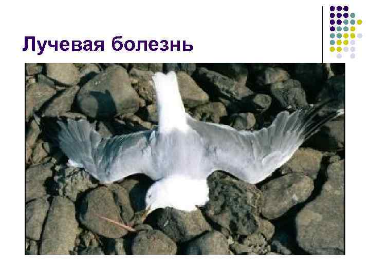 Лучевая болезнь 