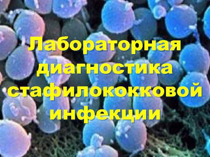 Лабораторная диагностика стафилококковой инфекции 