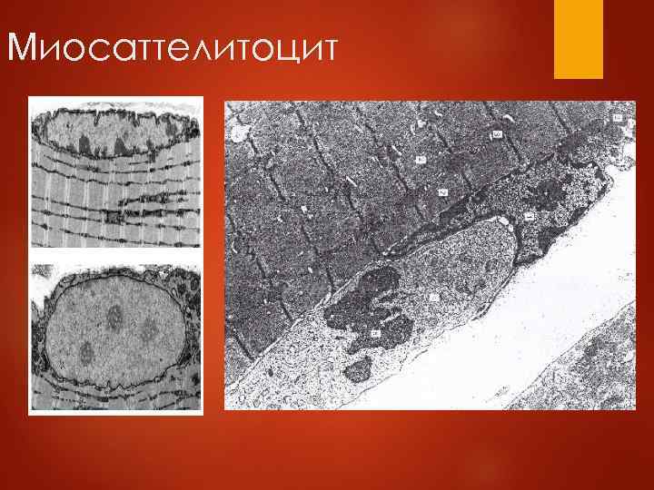 Миосаттелитоцит 