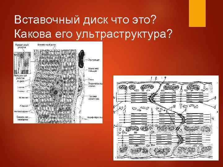 Вставочный диск что это? Какова его ультраструктура? 