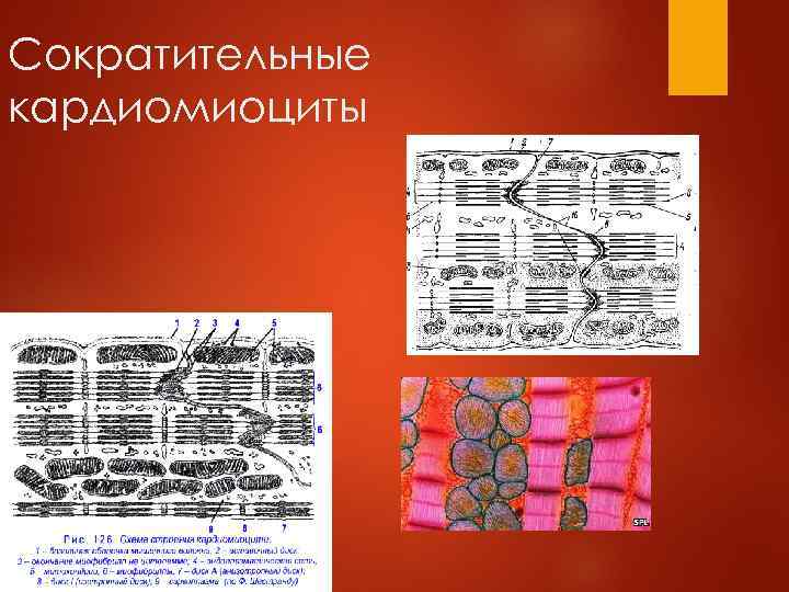 Сократительные кардиомиоциты 