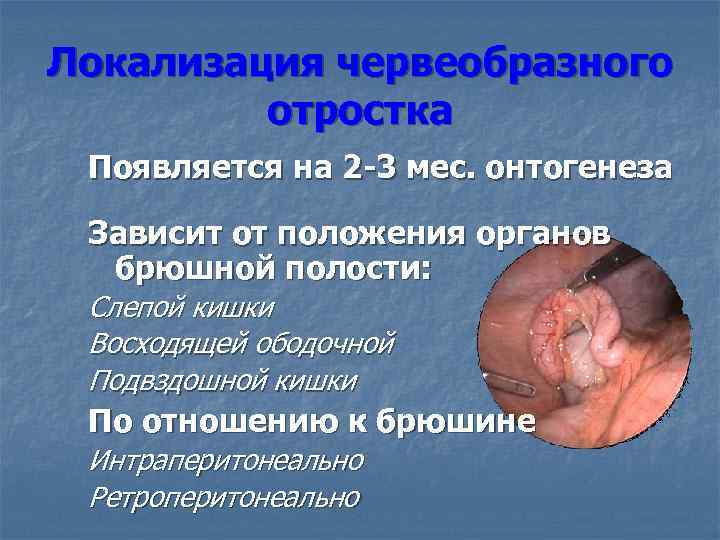 Локализация червеобразного отростка Появляется на 2 -3 мес. онтогенеза Зависит от положения органов брюшной