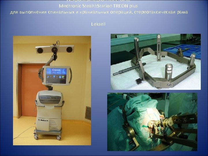 Нейронавигационная cтойка Medtronic Stealth. Station TREON plus для выполнения спинальных и краниальных операций, стереотаксическая