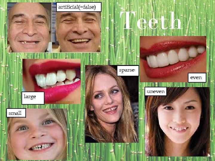 artificial(=false) Teeth sparse even large small uneven 