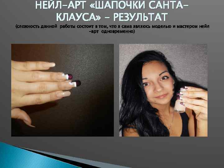 НЕЙЛ-АРТ «ШАПОЧКИ САНТАКЛАУСА» - РЕЗУЛЬТАТ (сложность данной работы состоит в том, что я сама