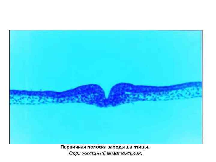 Первичная полоска зародыша птицы. Окр. : железный гематоксилин. 