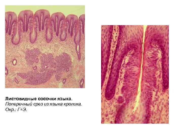 Листовидные сосочки языка. Поперечный срез из языка кролика. Окр. : Г+Э. 