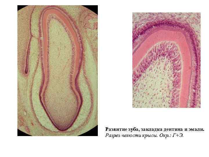 Развитие зуба, закладка дентина и эмали. Разрез челюсти крысы. Окр. : Г+Э. 
