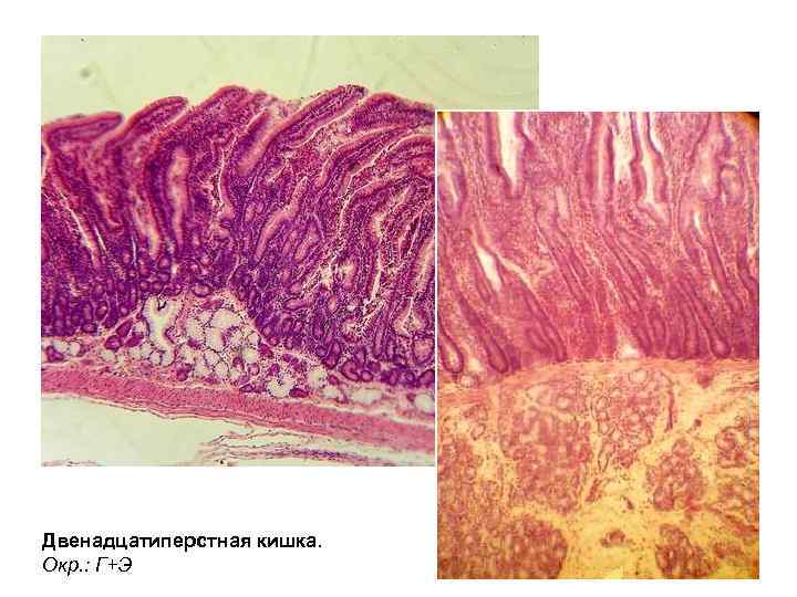 Двенадцатиперстная кишка. Окр. : Г+Э 