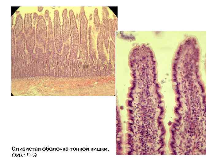 Слизистая оболочка тонкой кишки. Окр. : Г+Э 