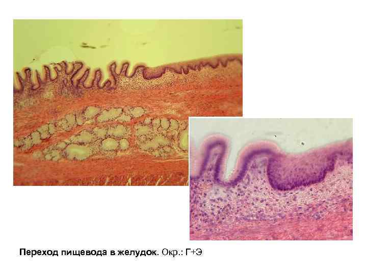 Переход пищевода в желудок. Окр. : Г+Э 