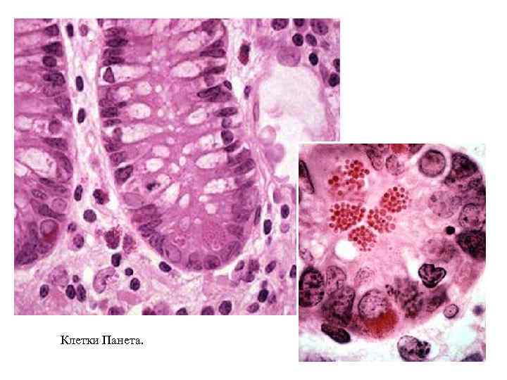 Клетки Панета. 