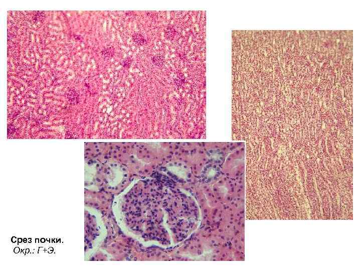 Срез почки. Окр. : Г+Э. 