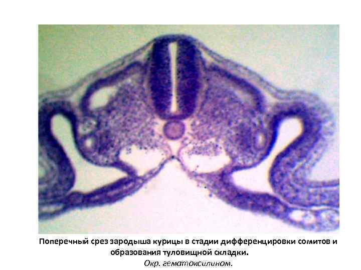 Поперечный срез зародыша курицы в стадии дифференцировки сомитов и образования туловищной складки. Окр. гематоксилином.