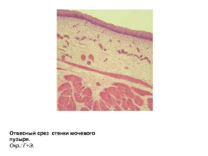Отвесный срез стенки мочевого пузыря. Окр. : Г+Э. 