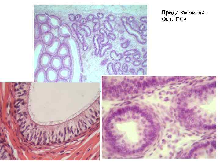 Придаток яичка. Окр. : Г+Э 