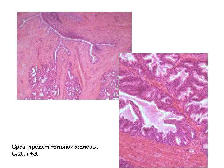 Срез предстательной железы. Окр. : Г+Э. 