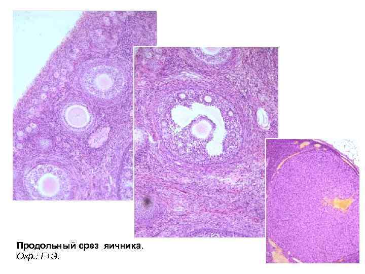 Продольный срез яичника. Окр. : Г+Э. 