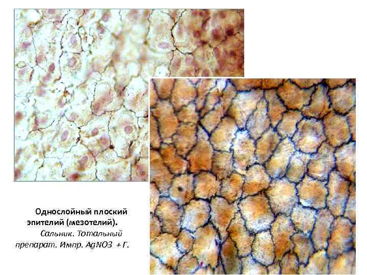 Однослойный плоский эпителий (мезотелий). Сальник. Тотальный препарат. Импр. Ag. NO 3 + Г. 