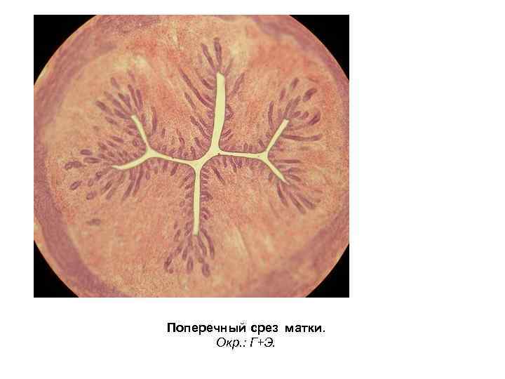 Поперечный срез матки. Окр. : Г+Э. 