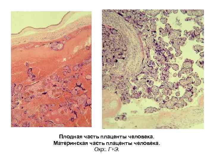 Плацента гистология. Плодная часть плаценты гистология. Материнская часть плаценты гистология препарат. Плодная и материнская часть плаценты гистология. Плацента гистология препарат.