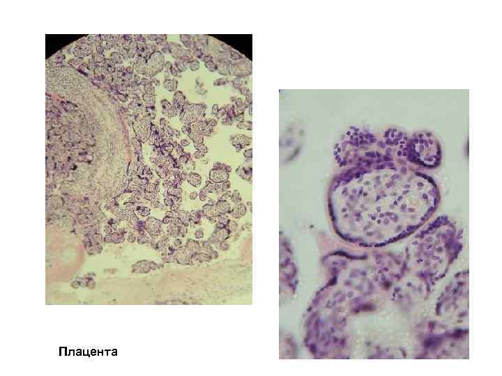 Плацента 