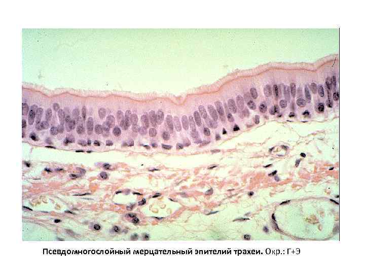 Псевдомногослойный мерцательный эпителий трахеи. Окр. : Г+Э 