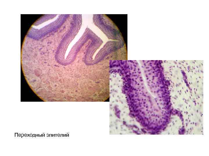 Переходный эпителий 