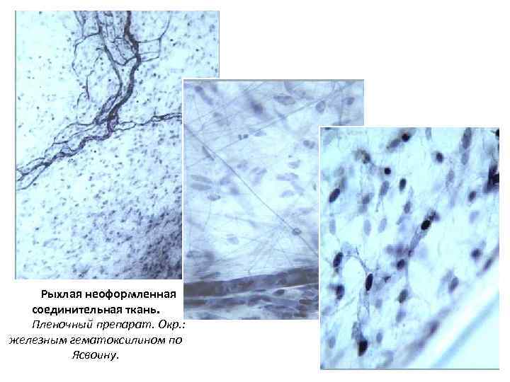 Рыхлая неоформленная соединительная ткань. Пленочный препарат. Окр. : железным гематоксилином по Ясвоину. 