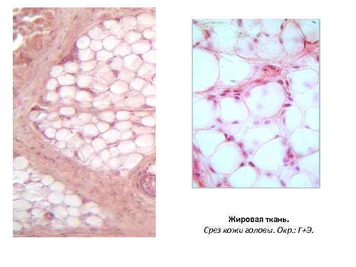 Жировая ткань. Срез кожи головы. Окр. : Г+Э. 