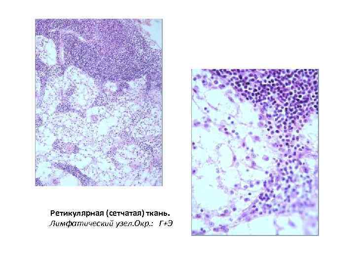 Ретикулярная (сетчатая) ткань. Лимфатический узел. Окр. : Г+Э 