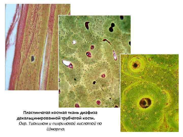 Пластинчатая костная ткань диафиза декальцинированной трубчатой кости. Окр. Тионином и пикриновой кислотой по Шморлю.