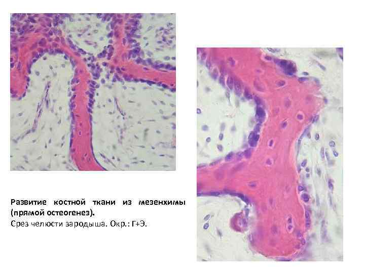 Развитие костной ткани из мезенхимы (прямой остеогенез). Срез челюсти зародыша. Окр. : Г+Э. 