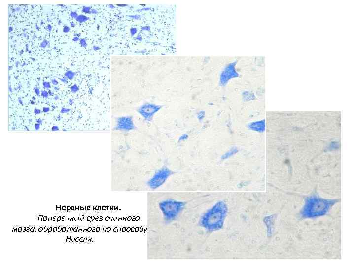 Нервные клетки. Поперечный срез спинного мозга, обработанного по споособу Ниссля. 