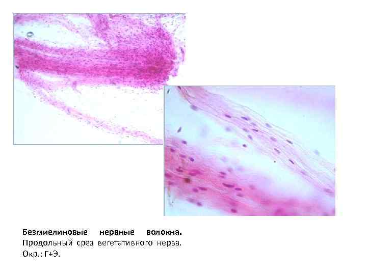 Безмиелиновые нервные волокна. Продольный срез вегетативного нерва. Окр. : Г+Э. 