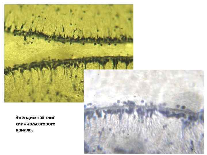 Эпендимная глия спинномозгового канала. 