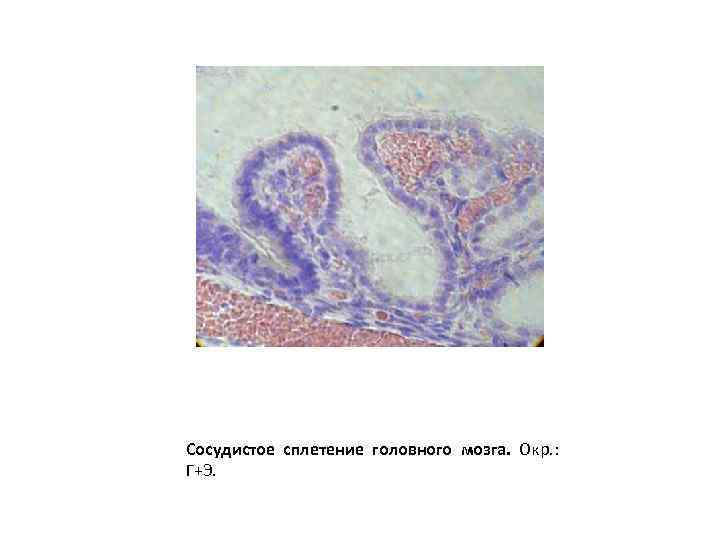 Сосудистое сплетение головного мозга. Окр. : Г+Э. 