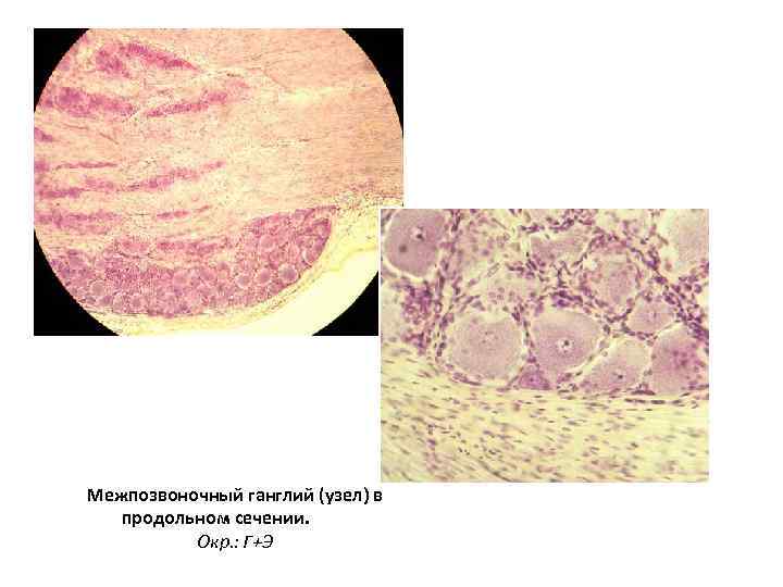 Межпозвоночный ганглий (узел) в продольном сечении. Окр. : Г+Э 